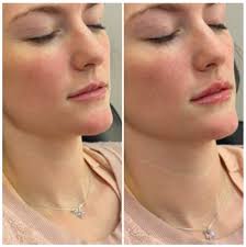 Cast Your Vote for the Top 100 Best Aesthetic Injectors in the USA 2026