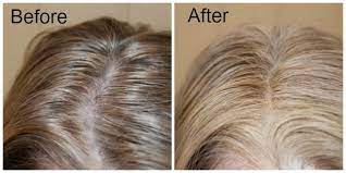 Agebeautiful Root Touch Up Spray Just Look At How A Few Sprays Turns My Dark Roots Blonde Again Available At Sal Root Touch Up Root Touch Up Spray Roots Hair