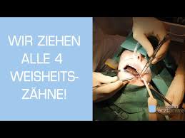 Bis dahin sollte die schwellung bereits wieder zurückgegangen sein. Weisheitszahn Op Unter Vollnarkose Youtube