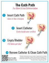 Urethral-locating device to assist with female clean intermittent self- catheterization | Explore Technologies