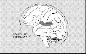 Check spelling or type a new query. Aspectos Generales De La Afasia De Conduccion Espaciologopedico