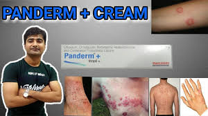 Detail Of Panderm Cream In Hindi In Which Skin Disease Panderm Plus Cream Should Use Youtube Panderm plus cream | panderm plus cream ke fayede or kaise use kare ? detail of panderm cream in hindi in which skin disease panderm plus cream should use