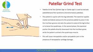 Image result for Patellar Tilt Test
