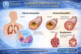 Image result for Chronic Bronchitis