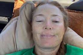 Fundraiser for Claudia Ogilvie by Ann Whiting : Skye Ogilvie Emergency  Surgery