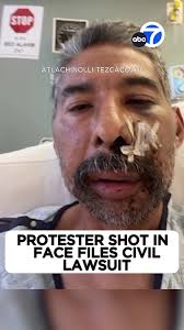 Uncovering the Mystery of the Pasadena Pee Bandit