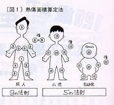 皮膚のやけどについて