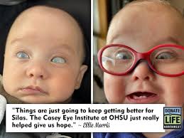 The Power of Medical Innovation: Silas' Journey to Sight