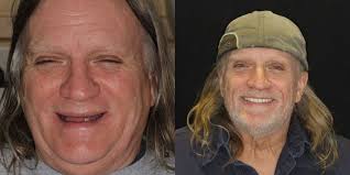 Transformative Dental Before & After