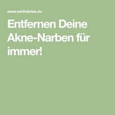 Entfernen Deine Akne Narben Fur Immer Akne Narben Akne Narben