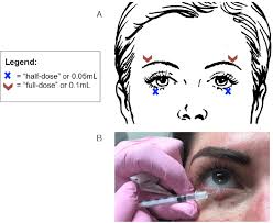 Image result for Botulinum Toxin Injection