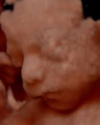 Photo by Dr. Felipe Greco