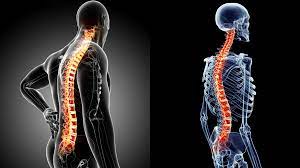 Use them in commercial designs under lifetime, perpetual & worldwide rights. Spinal Curves What Is The Ideal Shape Of The Spine Norwest Chiro