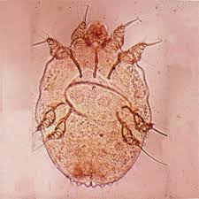 Image result for Sarcoptes scabiei