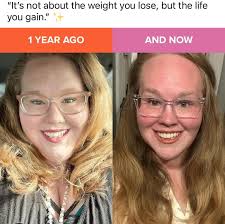 Bariatric surgery weight loss progress