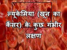The symptoms include a lump or swelling around the tummy or in your child's legs, upper chest, neck, or face. à¤² à¤¯ à¤ à¤® à¤¯ à¤ à¤¨ à¤ à¤ à¤¸à¤° à¤ à¤ à¤ à¤ à¤­ à¤° à¤²à¤ à¤·à¤£ Blood Cancer Symptoms In Hindi Youtube