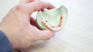 A dental implant starts at $1,500, which is over the coverage limit for many plans. Full Mouth Tooth Replacement Cost Of Full Mouth Dental Implants In Milwaukee Ross Dental Family Restorative Cosmetic And Sedation Dentistry New Berlin Wi