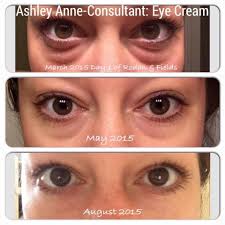 Shop from the world's largest selection and best deals for men dark circles cream eye treatments & masks. Everyone Men Too Could Use A Good Eye Cream With Macadamia Seed Oil Caffeine Ginkgo B Multifunction Eye Cream Eye Cream For Dark Circles Eye Bags Makeup