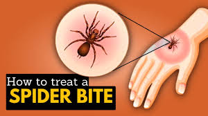Image result for yellow sac spider bite skin