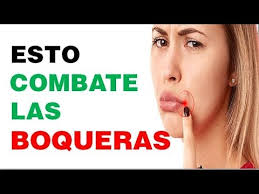 Check spelling or type a new query. 3 Sencillos Remedios Caseros Para La Queilitis Angular O Boqueras Youtube