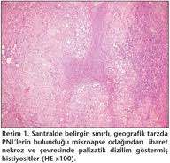 Flora Infeksiyon Hastaliklari Ve Klinik Mikrobiyoloji Dergisi Azitromisinle Tedavi Edilen Muhtemel Uc Kedi Tirmigi Hastaligi Olgusu