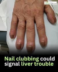 Image result for Digital Clubbing