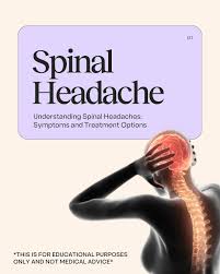 Image result for Spinal Headache