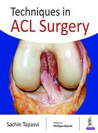 Reasons to have acl surgery. Techniques In Acl Surgery English Edition Ebook Tapasvi Sachin Amazon De Kindle Shop