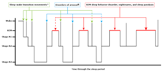 Rapid Eye Movement Sleep Behavior Disorder Uptodate