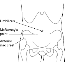 Image result for Point of Maximum Impulse