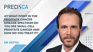 How often do you see small cell prostate cancer and how do you treat it?
