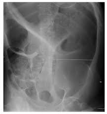 Pin En Cirugia