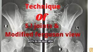 Welcome to the official global facebook page of massey ferguson. Technique Of S I Joints Mfv Ep 39 Modified Ferguson View Sacroiliac Joint Oblique View Youtube