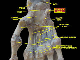 Image result for Pisiform Bone