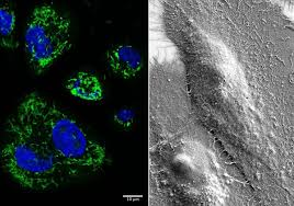 When cancer cells do this, it's called metastasis. Cheese Preservative Slows Oral Cancer Spread In Mice Study The Scientist Magazine