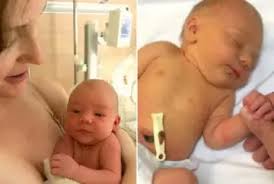 Baby-Friendly Protocol Complications in the Media