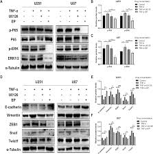 Ethyl Pyruvate Inhibits Glioblastoma Cells Migration And Invasion Through Modulation Of Nf Kb And Erk Mediated Emt Peerj
