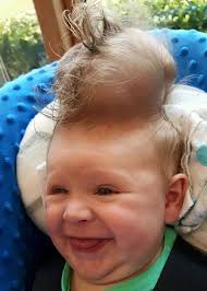 Born with his brain outside his skull