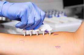 Image result for Allergy Screening