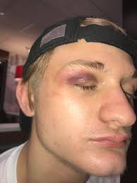 Mom's son gets concussion in wrestling match
