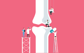 In a hip resurfacing surgery, the implant is smaller, and less normal bone is removed. Suffering From Bad Knees Some Look For Alternatives To Surgery The Washington Post