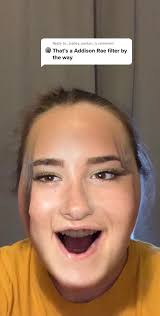 Thanks for all of your concerns lovely’s! Keep commenting more question!!  ❤️🍩#fyp #imzoescousin #zoelaverne