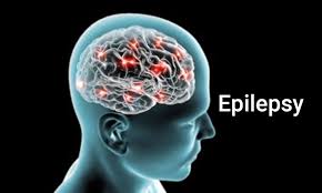 What Are The Causes, Symptoms And Diagnosis Of Epilepsy ?