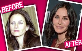 Learn about the ten most frequently performed cosmetic surgeries in the united states. About Face Courteney Cox Bit By The Surgery Bug