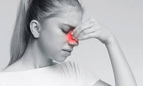 Stapokibart found to be superior to placebo for severe chronic  rhinosinusitis with polyps