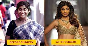 Trained in prestigious medical institutions and with more than 18000 surgeries under his belt dr. 11 Bollywood Actress Who Have Allegedly Undergone Plastic Surgery