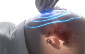 In der schwangerschaft ist die ultraschalluntersuchung des ungeborenen babys für den arzt eines der im verlauf dieser ultraschalls schließen wir auffälligkeiten wie fehlbildungen, mangelzustände o.ä. á… 4d Ultraschall In Der Schwangerschaft Risiken Und Kosten
