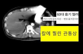 칼에 찔린 관통상의 치료는 어떻게 할까요? : 네이버 블로그