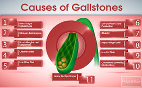 22 Symptoms Of Gallbladder Disease Drjockers Com In 2020 Gallstones Gallbladder Symptoms Gallbladder Stones