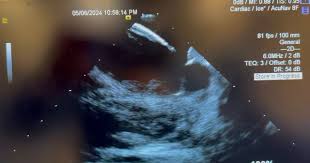 @AlbertLinMD1's video Tweet